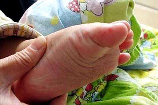 手足口水痘猩红热都得过,幼儿急疹猩红热水痘手足口鉴别