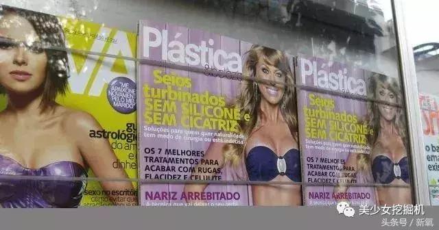 巴西真人芭比16岁开始疯狂整形40次，最后把胸整成了足球场
