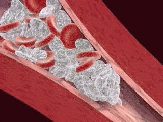 人的血管怎么清洗,为什么保养血管很重要