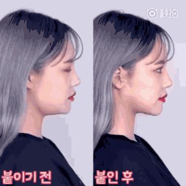 抖音上很火的瘦脸贴,瘦脸贴网红