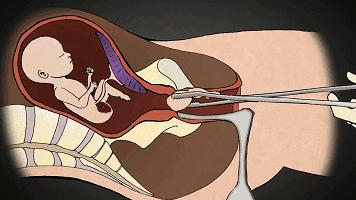 男朋友发微信来如何高情商回复,微信套路回复