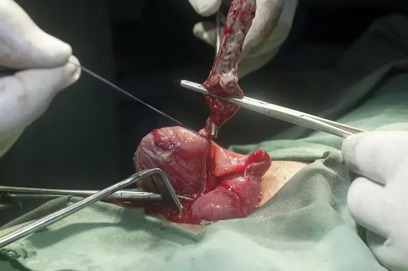 中医郭生白治疗阑尾炎的方子,扶阳经方传承人郑佑民