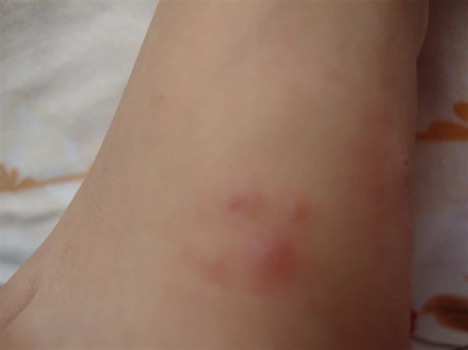 预防手足口病,预防手足口病儿歌