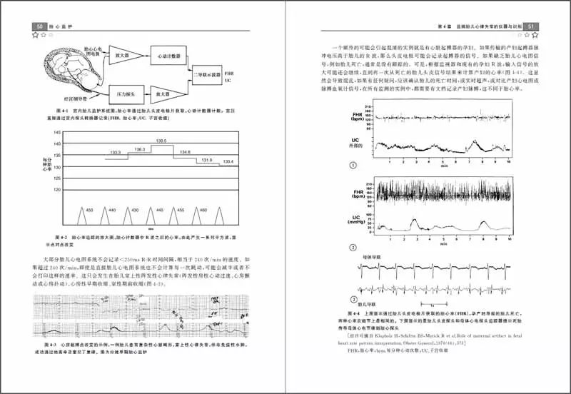 胎心监护13次,胎心监护18次