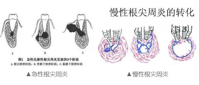 战痘多年才知道的真相,战痘多年不见效果