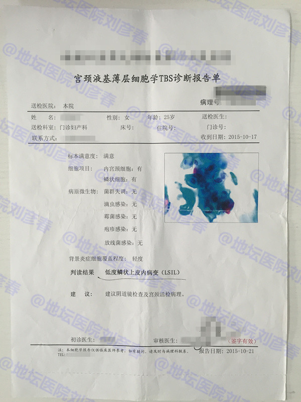 未育女性宫颈锥切,做过宫颈锥切后又感染hpv该怎么办