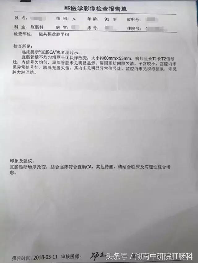 直肠癌康复视频,直肠癌患者术后的护理个案报告
