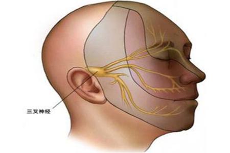 引起面部三叉神经疼的原因,三叉神经痛显微减压手术危险吗