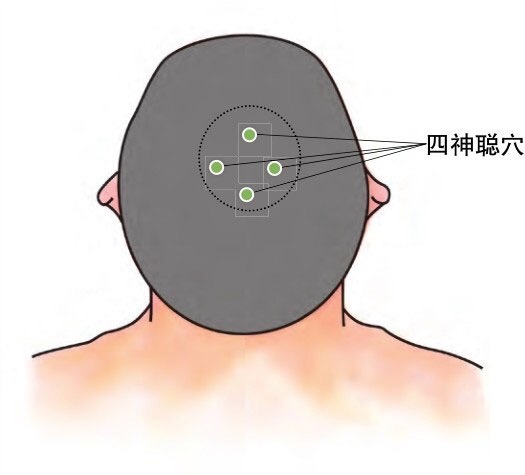 高考期间焦虑，头痛头晕失眠，心慌怎么办？