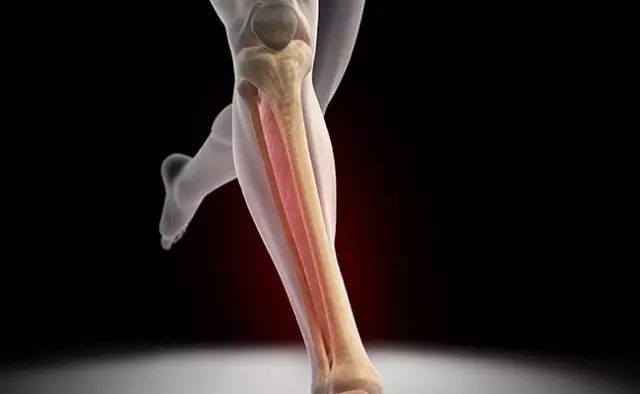 跑者最易受伤的三个部位,四种常见的运动损伤