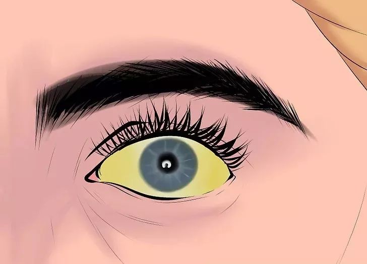 肝癌初期身体的四个症状藏不住,不痛不痒的肝癌是良性还是恶性