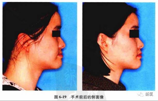 迪丽热巴被p图事件回应,迪丽热巴被p图的视频