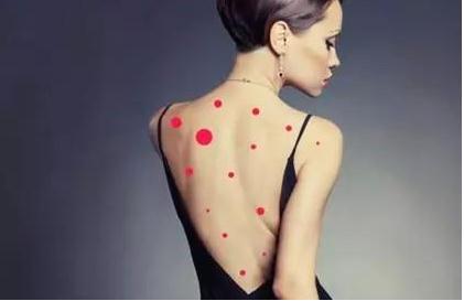 后背长螨虫痘用什么药膏,后背长痘的有效祛痘方法