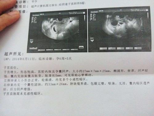 孕囊周边不规则无回声，这种情况怎么办？