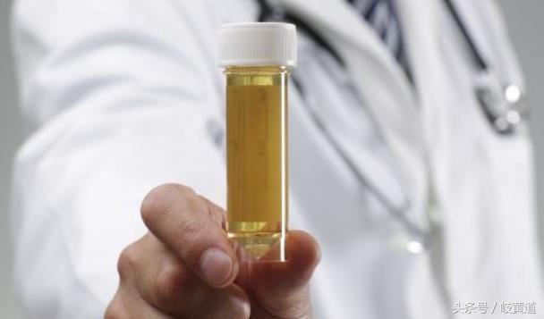 尿常规检查的各项指标及含义图解,尿常规怎么看图解