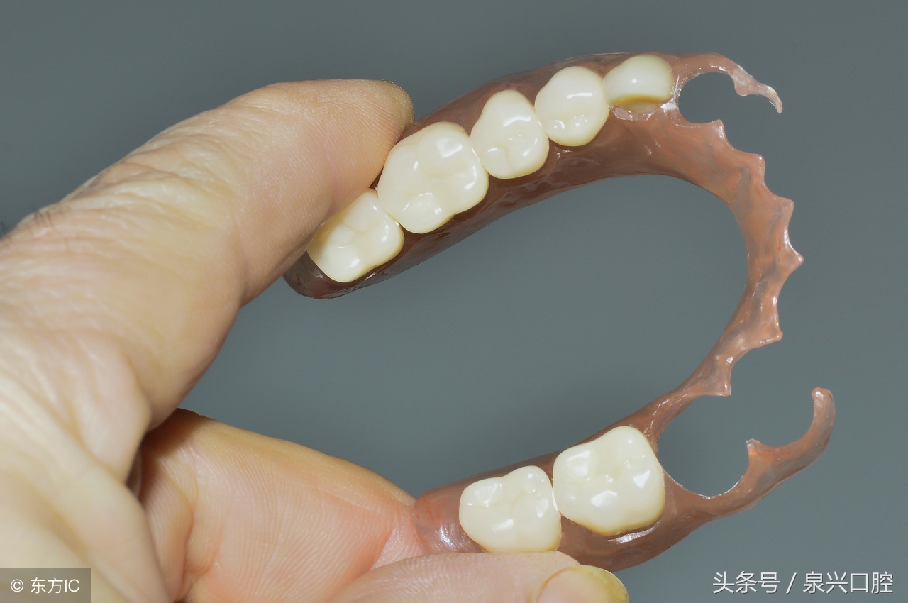 缺牙的话选择种植还是矫正,缺牙选种牙还是烤瓷牙好