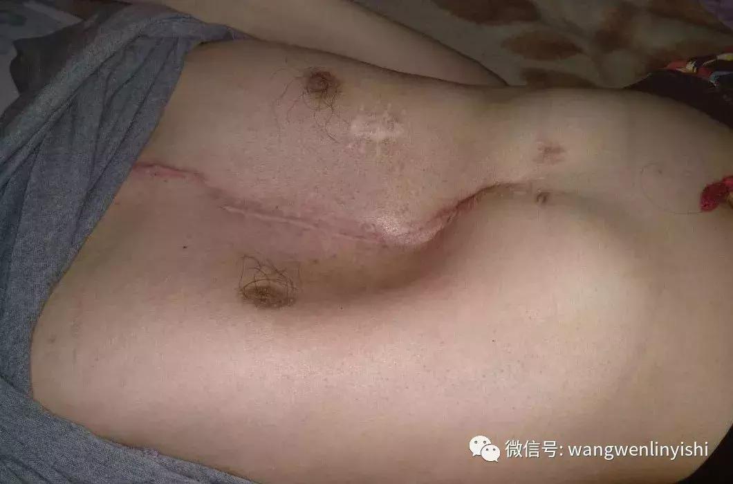 为什么说心脏外科是外科手术禁区,心脏外科在医学界多重要