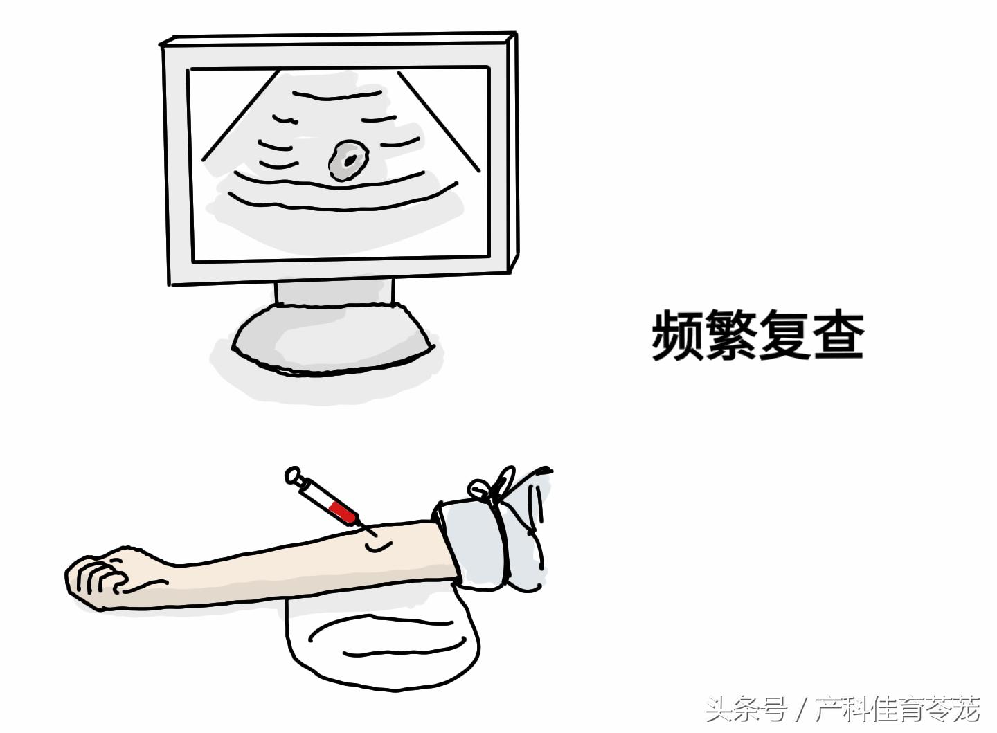 绒毛膜下血肿一定要卧床休息吗,绒毛膜下血肿保胎最佳方法