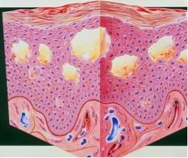身上出了一片一片的小疙瘩,身上出来小疙瘩硬硬的有黄水