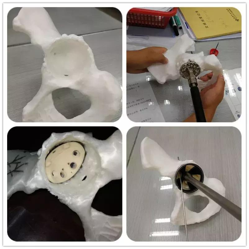 老年人关节老化需要做手术吗,老年人关节老化要动手术吗