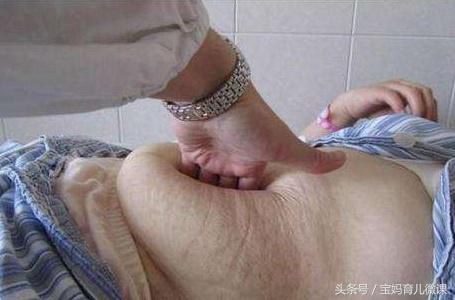 剖腹产后有一种无法忘怀的痛叫：“按肚子”，经历的人最懂！