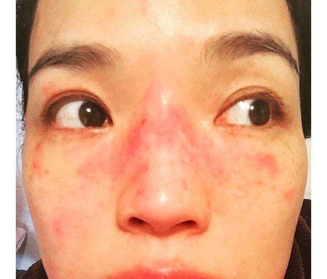 日本孕妇护肤品排行榜前十名,怀孕护肤品神仙水推荐