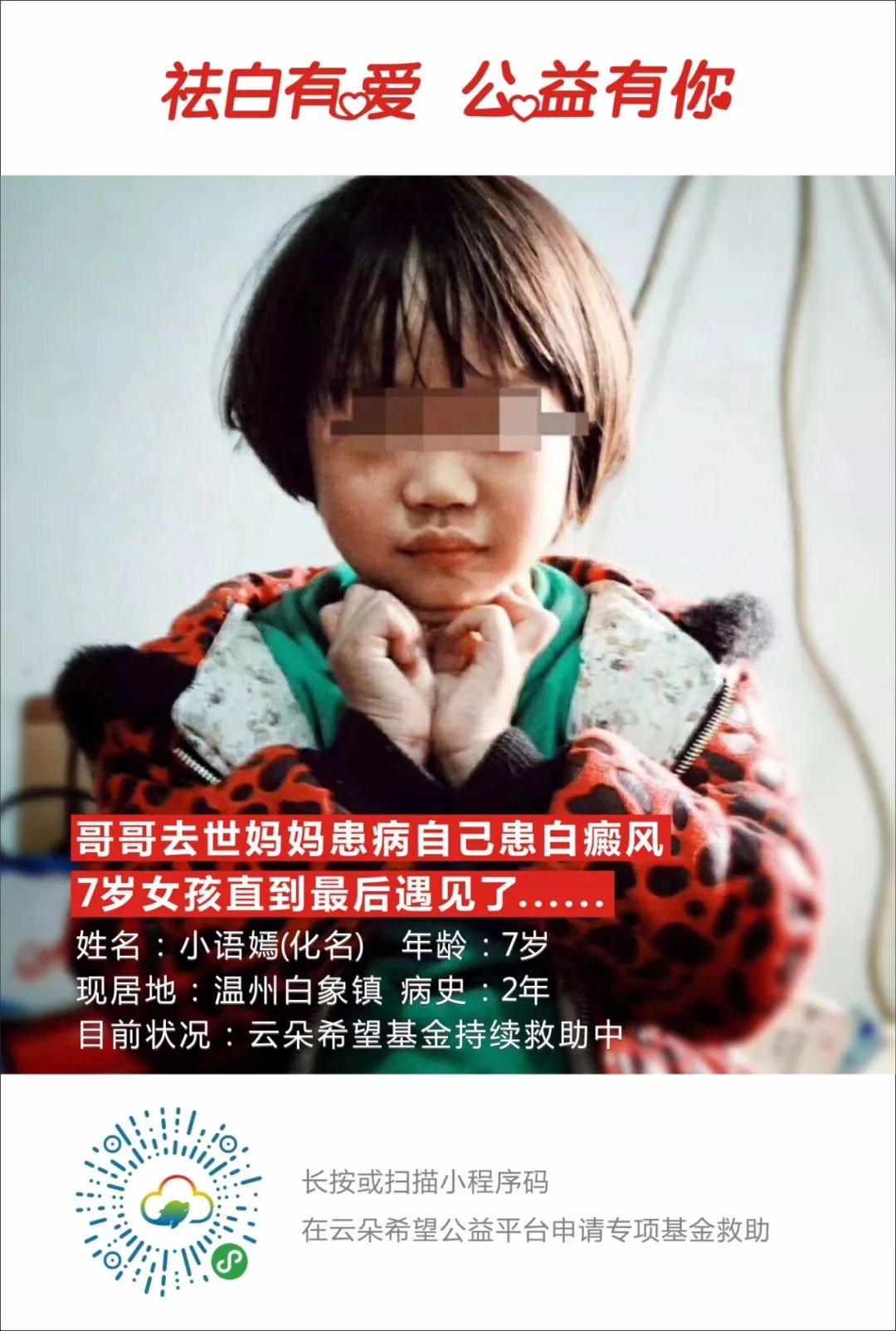 白癜风慈善基金申请,白癜风公益计划