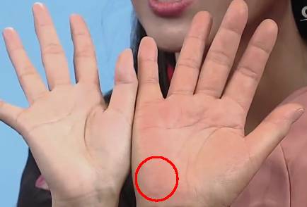 手健康有多重要,手型看健康