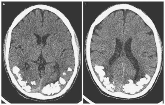 阴茎纹身还有这用处？医生应该见识的22个奇葩病例