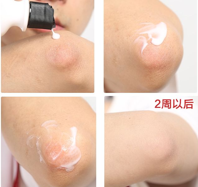 PP、腋下、手肘、三角区发黑暗沉？日本女*爱性**用好物，抹一抹，4周白嫩如少女！