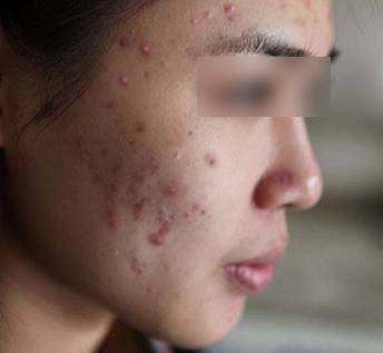 这72批次化妆品不合格你用了吗,国家药监局公布化妆品不合格