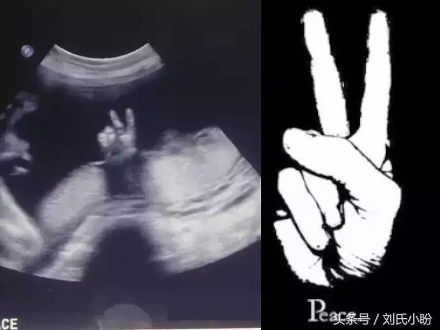 宝宝在肚子里胎动是怎样的,胎动时宝宝在肚子里做什么呀