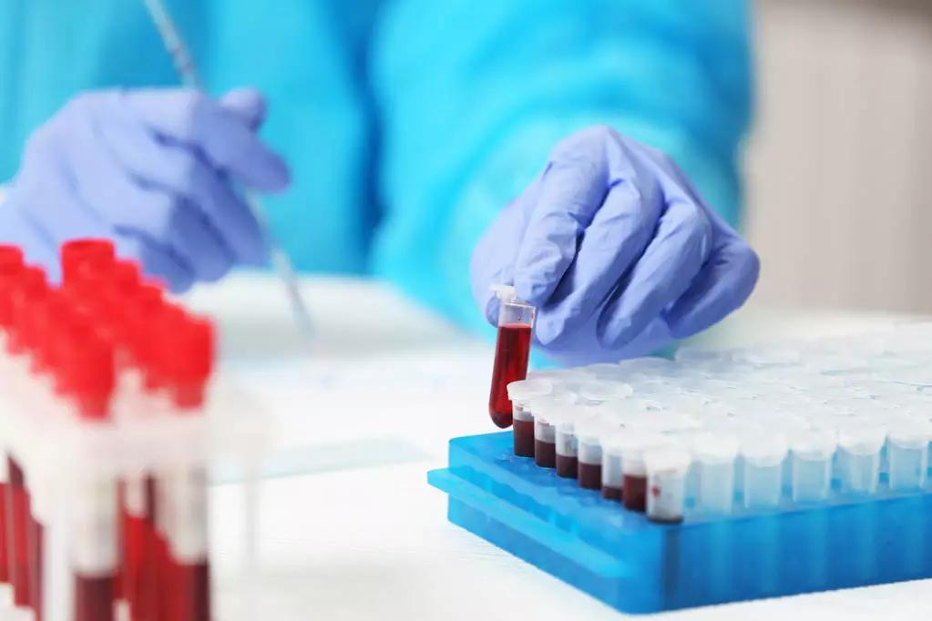 警惕这些症状可能是严重过敏反应,怎么才知道孩子是不是过敏体质