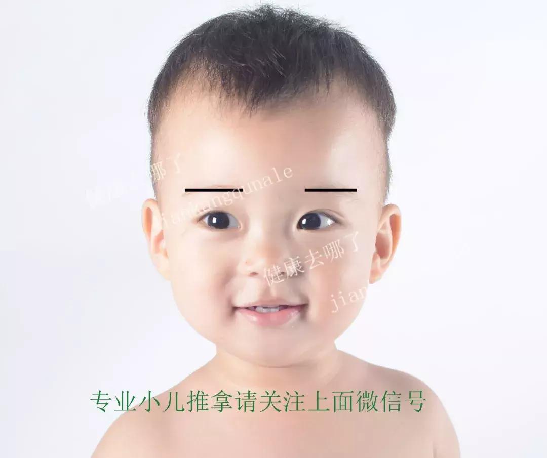 小儿睡觉易醒推拿哪些穴位,小儿睡眠障碍症怎么治疗