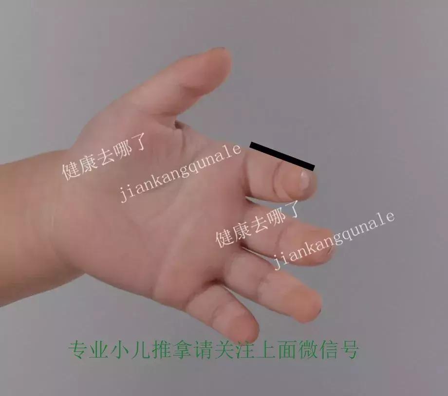 小儿睡觉易醒推拿哪些穴位,小儿睡眠障碍症怎么治疗