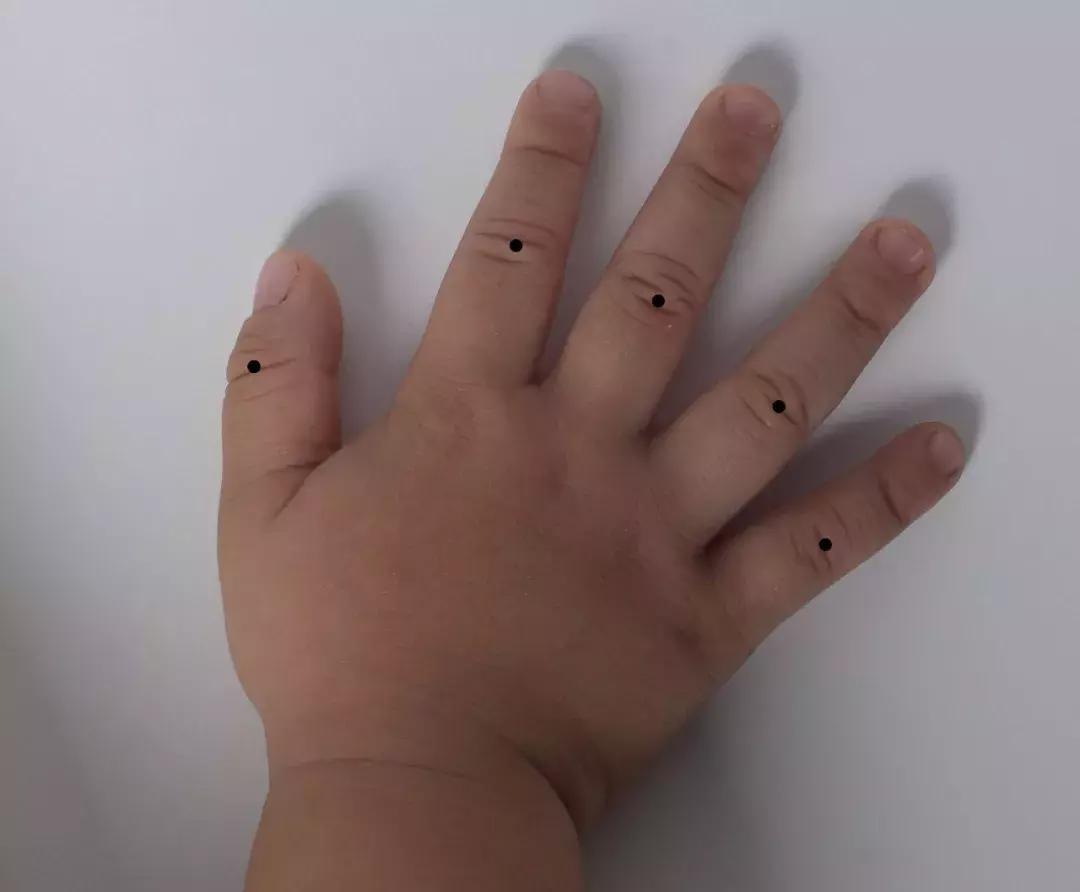 小儿睡觉易醒推拿哪些穴位,小儿睡眠障碍症怎么治疗