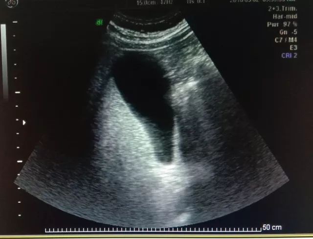 关于超声检查的问题,科普答疑