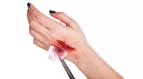 被铁哥们亲了一口，医生竟让我打破伤风？