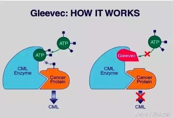 印度仿制白血病特效药,专治疗白血病的印度仿制药