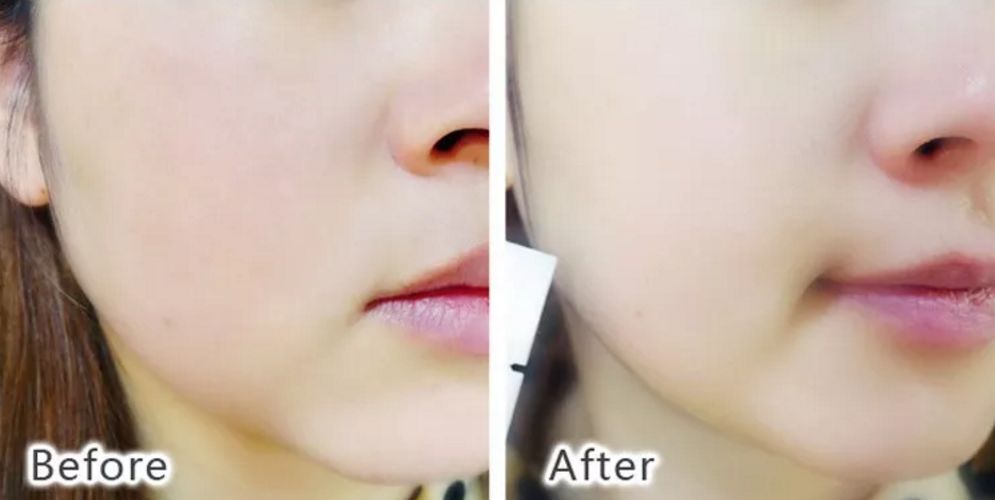 波兰院线面膜美白,深海白珍珠面膜