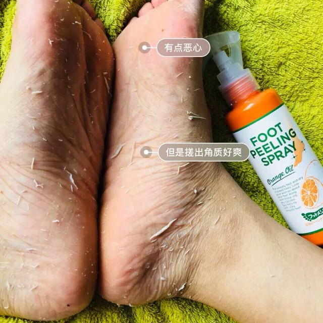 擦掉一块皮用什么药,擦掉了一小块皮一般需要多久恢复