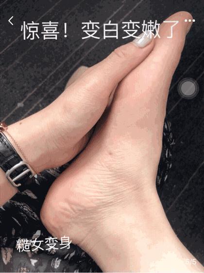 擦掉一块皮用什么药,擦掉了一小块皮一般需要多久恢复