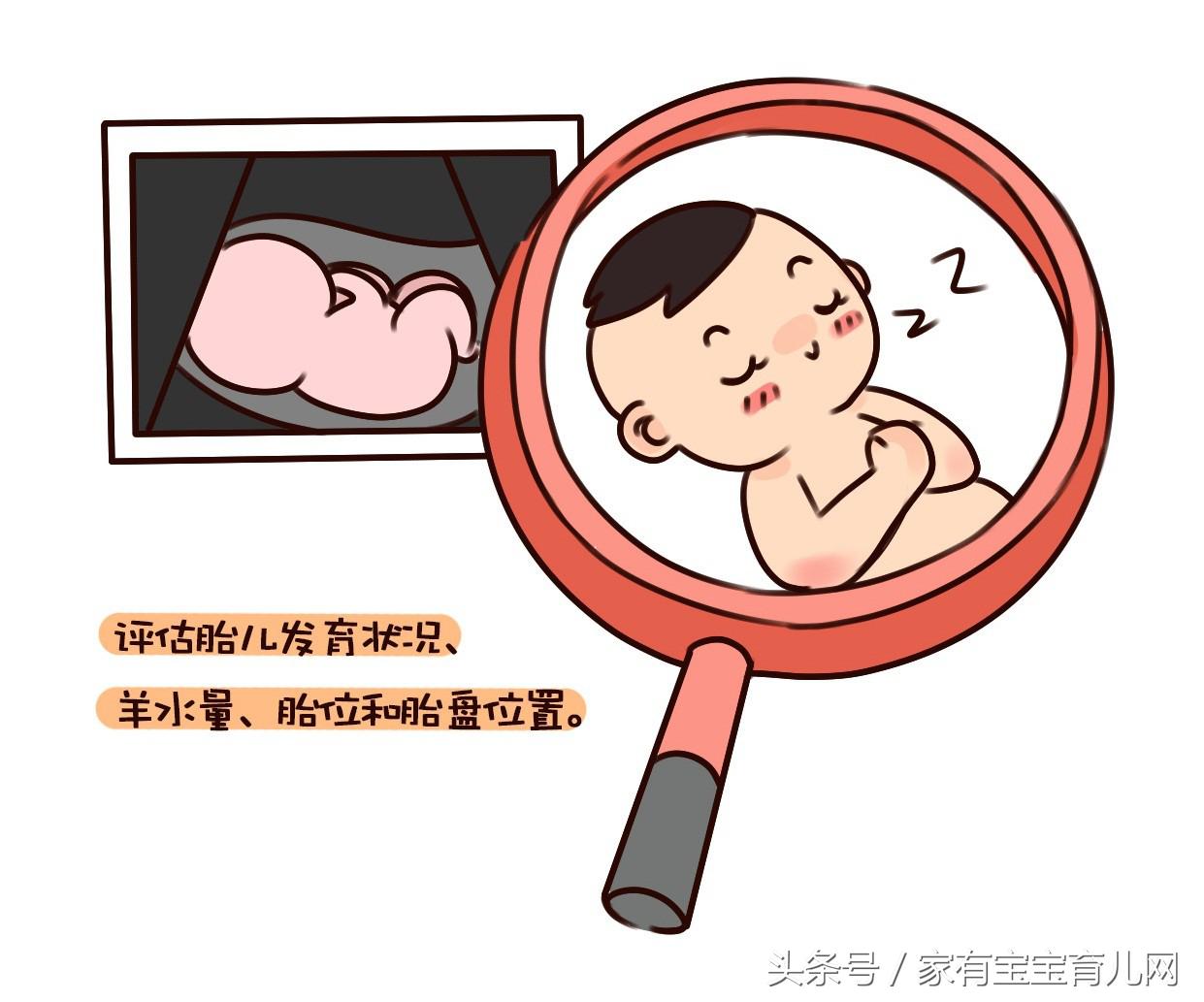 最全的产检时间表和项目唐氏,产检唐筛检查流程