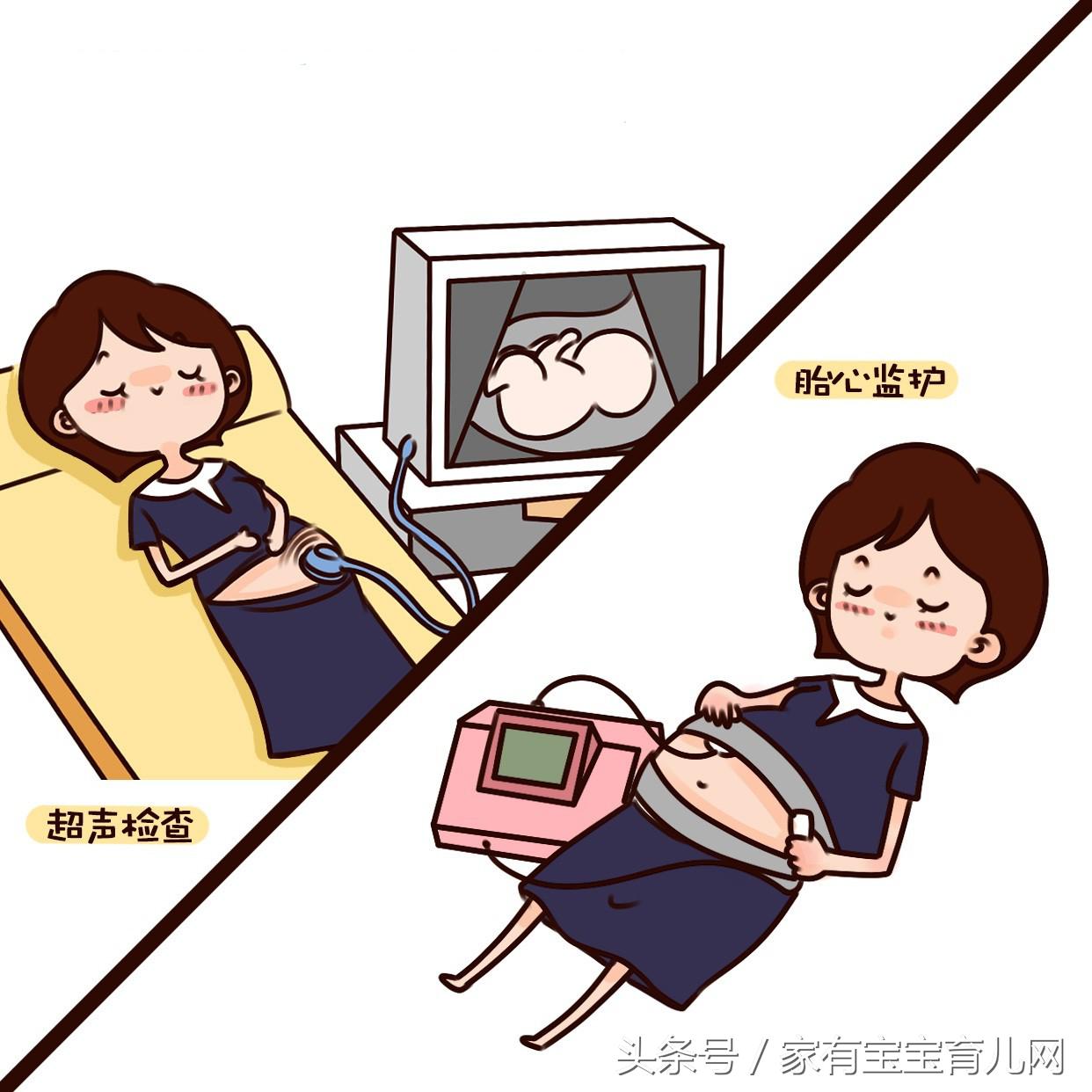 产检糖耐检查流程,最全的产检时间表和项目唐氏