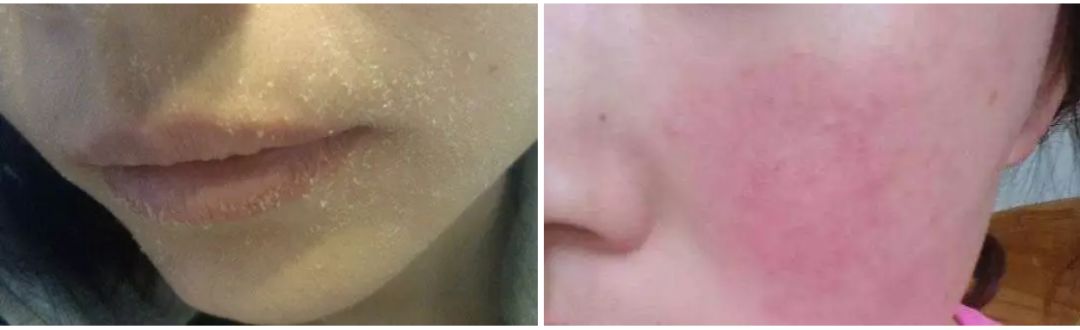 林允高光面膜推荐哪个,林允护肤视频推荐什么面膜