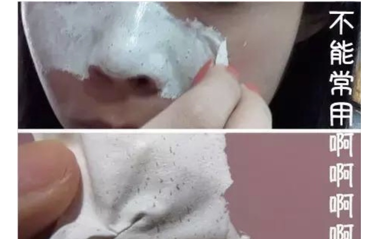 女生毛孔超级粗大,女生毛孔粗大用什么药膏