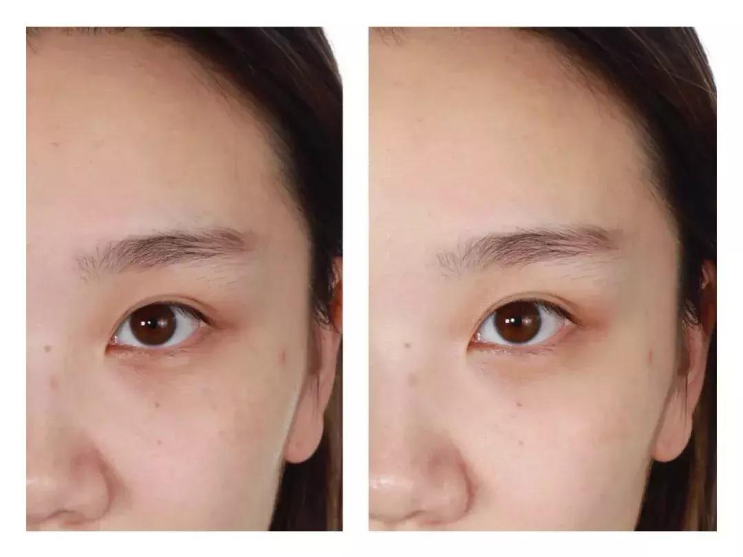 纯露敷脸,纯露敷脸护肤法