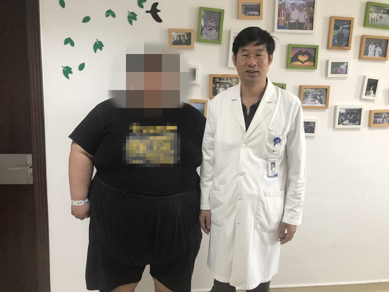 身高1.72米体重62公斤正常吗,身高1m72体重112胖不胖