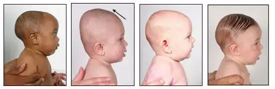 宝宝睡圆头平躺要睡多久,5个月宝宝头睡平了还能圆回来吗