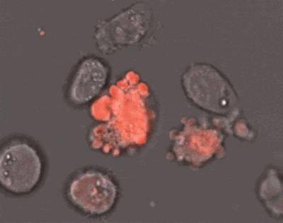 肿瘤细胞免疫治疗是什么,细胞免疫治疗视频大全